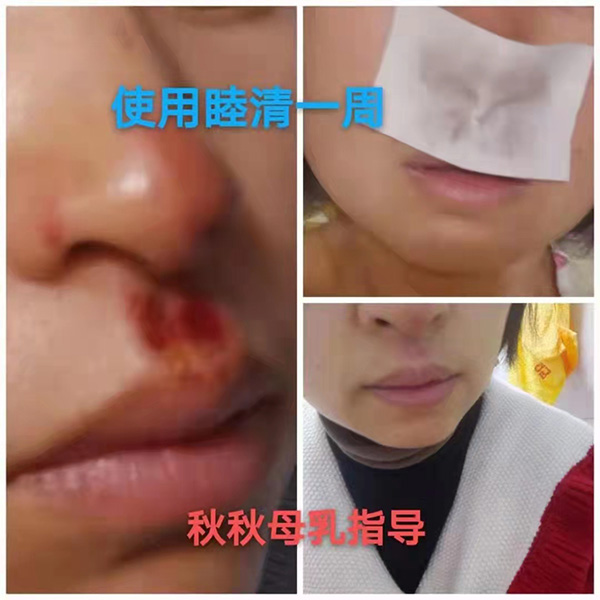 �����澏���N���Æ᣿���M(f��i)�߿ڱ���������(sh��)���a(ch��n)ƷȦ�۟o��(sh��)