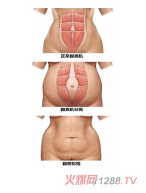 ���������îa���Ŀ-��ֱ���ޏ�